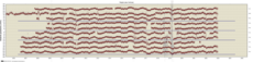 Link to vertical data